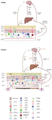 The shaping of gut immunity in cirrhosis